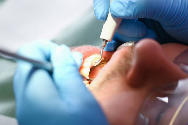 Best Orthodontic Emergency Dentist in Greensburg, PA